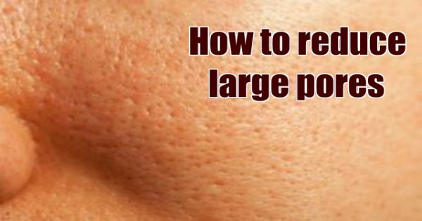 7 Ways to Get Rid of Large Pores → PERMANENTLY ← on your Face